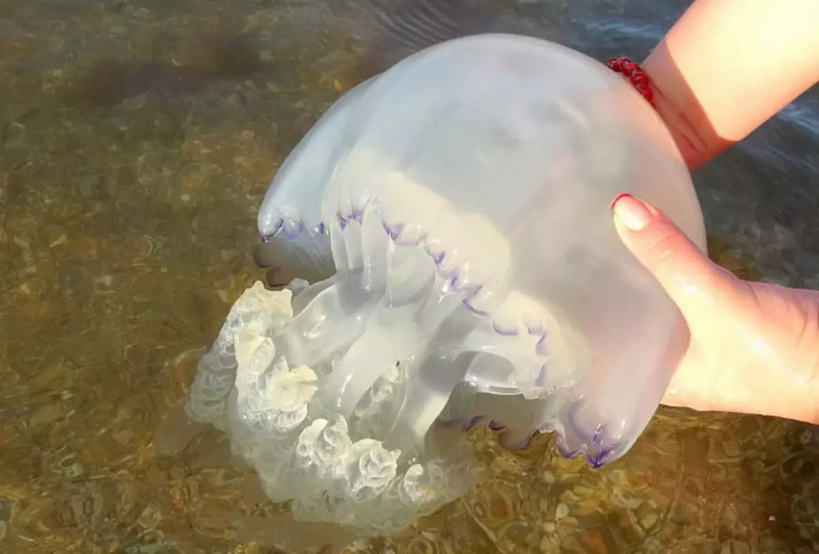 Как лечить ожог медузы у ребёнка, рассказала люберецкий врач-травматолог