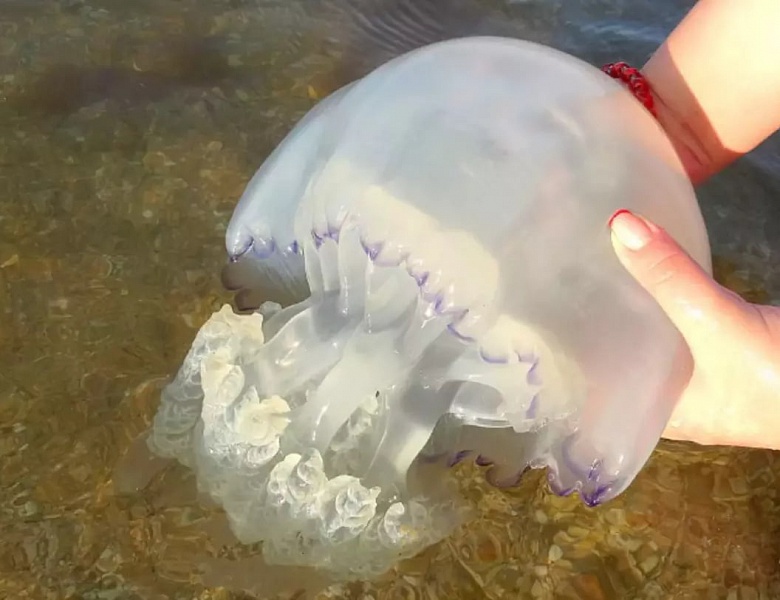 Как лечить ожог медузы у ребёнка, рассказала люберецкий врач-травматолог